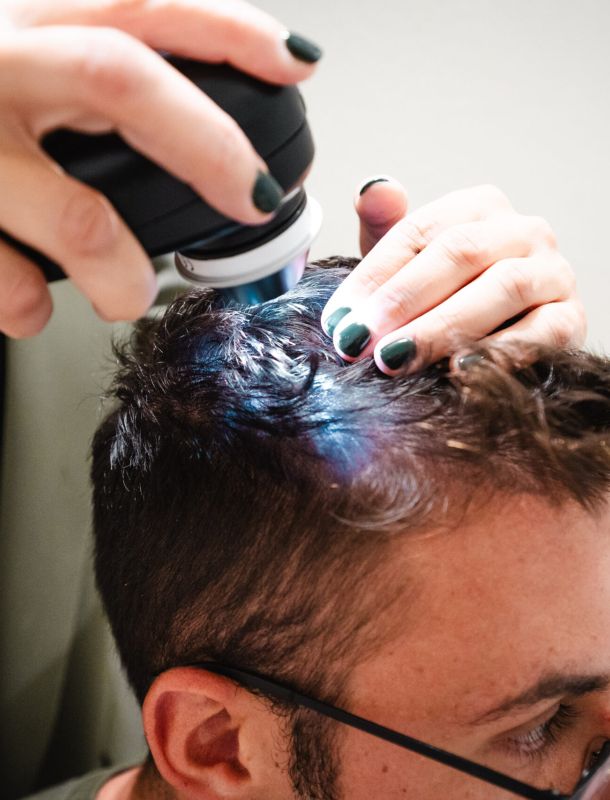 consulenza tricologica